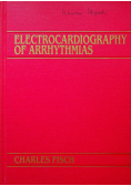 Electrocardiography of Arrhythmias