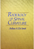 Radiology of Spinal Curvature