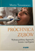 Próchnica zębów wybrane problemy diagnostyki leczenia i zapobiegania