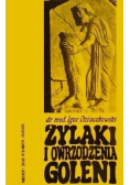 Żylaki i owrzodzenia goleni
