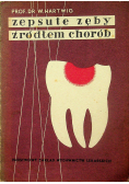Zepsute zęby źródłem chorób