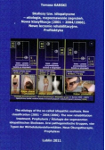 Skoliozy tzw idiopatyczne etiologia rozpoznawanie zagrożeń Nowa klasyfikacja ( 2001 - 2004 / 2006 ) Nowe leczenie rehabilitacyjne Profilaktyka Autograf autora