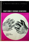 Zmiany skórne w chorobach wewnętrznych