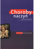 Choroby naczyń Wybrane problemy