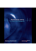 Stymulacja serca w elektrokardiografii
