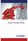 Patent Foramen Ovale