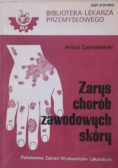 Zarys chorób zawodowych skóry