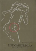 Endometrioza