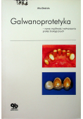 Galwanoprotetyka