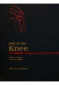 Mri of the Knee