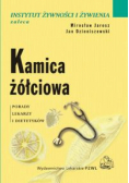 Kamica żółciowa