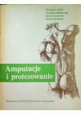 Amputacje i protezowanie