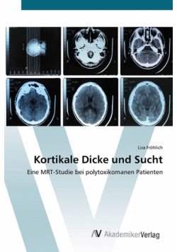 Kortikale Dicke und Sucht
