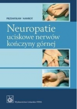 Neuropatie uciskowe nerwów kończyny górnej