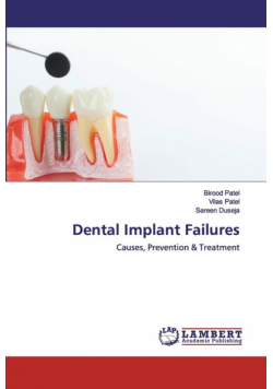 Dental Implant Failures