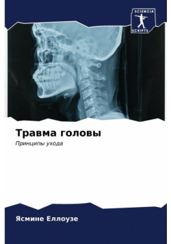 Травма головы