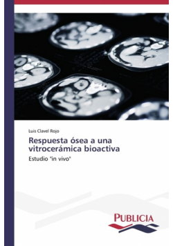 Respuesta ósea a una vitrocerámica bioactiva