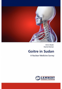 Goitre in Sudan