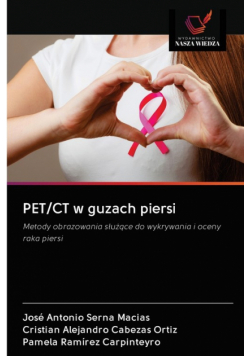 PET/CT w guzach piersi
