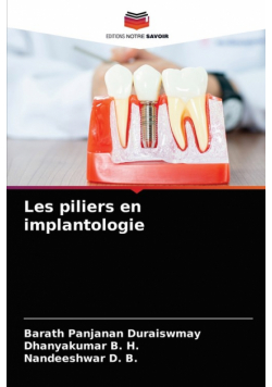 Les piliers en implantologie
