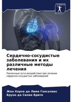 Сердечно-сосудистые заболевания и их различные методы лечения
