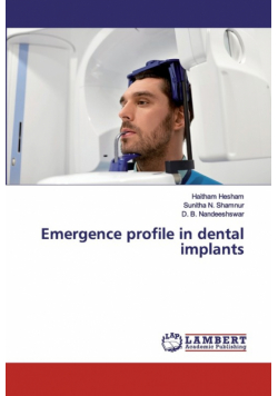Emergence profile in dental implants