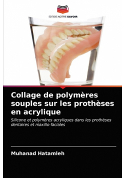 Collage de polymères souples sur les prothèses en acrylique