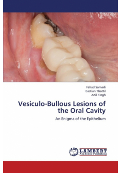 Vesiculo-Bullous Lesions of the Oral Cavity