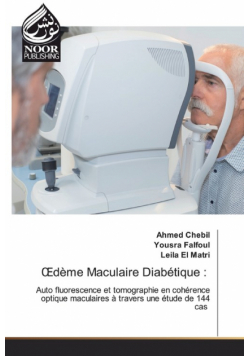 Œdème Maculaire Diabétique