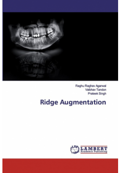 Ridge Augmentation