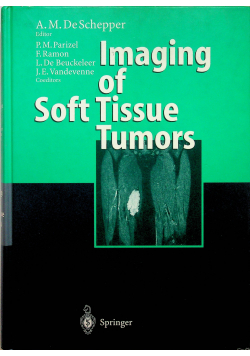 Imaging of Soft Tissue Tumors