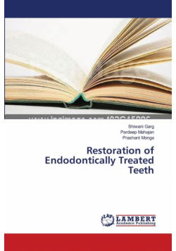 Restoration of Endodontically Treated Teeth