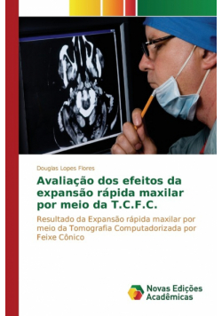 Avaliação dos efeitos da expansão rápida maxilar por meio da T.C.F.C.