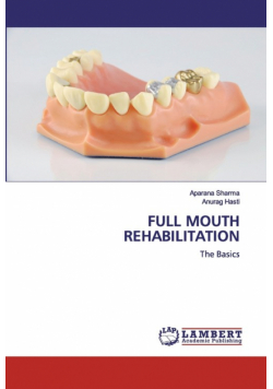 Full Mouth Rehabilitation