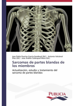 Sarcomas de partes blandas de los miembros
