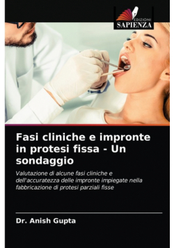 Fasi cliniche e impronte in protesi fissa - Un sondaggio
