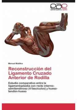 Reconstrucción del Ligamento Cruzado Anterior de Rodilla
