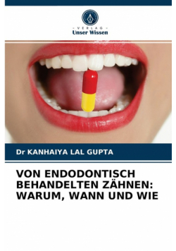 Von Endodontisch Behandelten Zähnen
