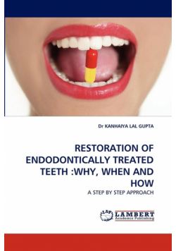 Restoration of Endodontically Treated Teeth