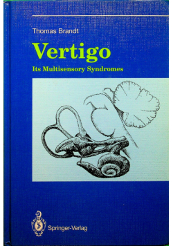 Vertigo Its Multisensory Syndromes