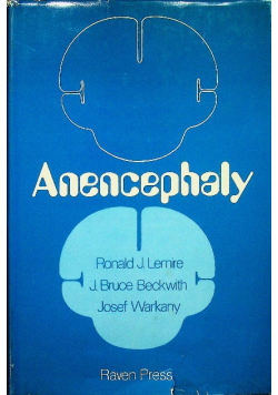 Anencephaly