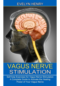 Vagus Nerve Stimulation