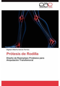 Protesis de Rodilla