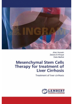 Mesenchymal Stem Cells Therapy for treatment of Liver Cirrhosis