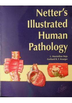Netters illustrated human Pathology