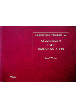A colour atlas liver transplantation