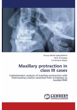 Maxillary Protraction in Class III Cases