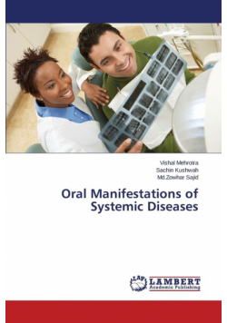 Oral Manifestations of Systemic Diseases