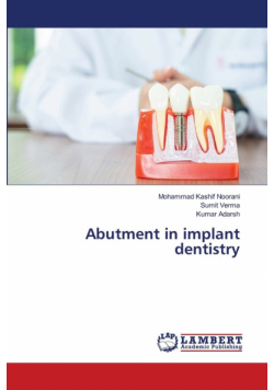 Abutment in implant dentistry