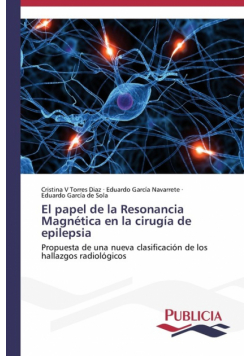 El papel de la Resonancia Magnética en la cirugía de epilepsia